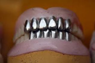 metallic denture