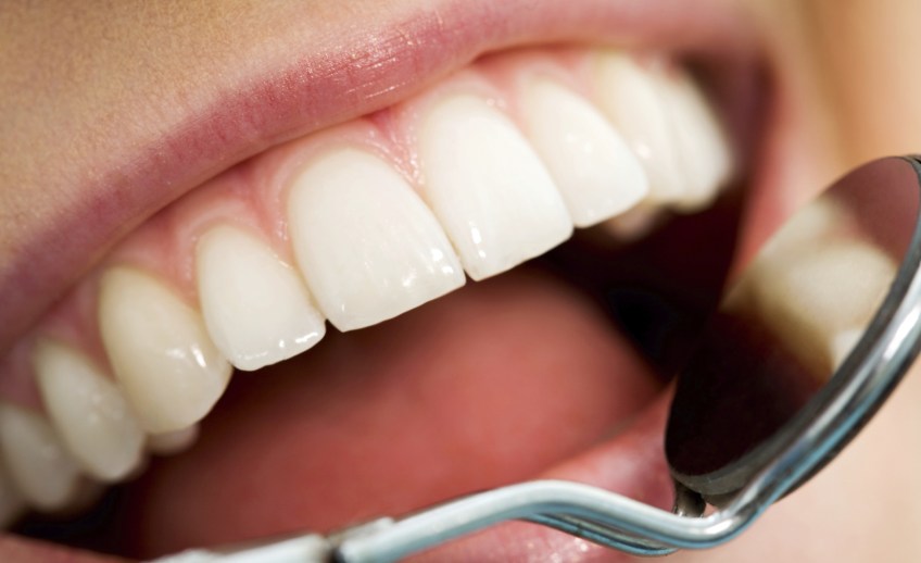 dental checkup