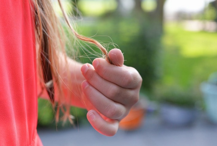 hair loss